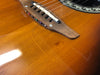 Ovation Legend 1617 Sunburst - 1981 Ovation Legend 1617 Sunburst - 1981